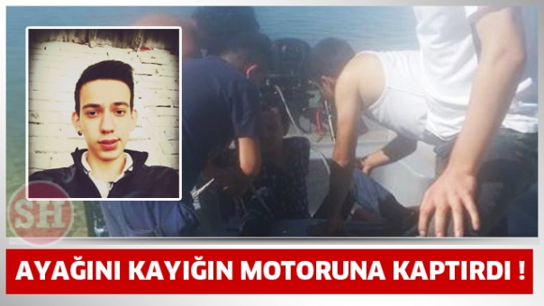 AYAĞINI MOTORUN PERVANESİNE KAPTIRDI