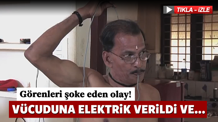 Görenleri Şoke Etti! Vücuduna Elektrik Verildi Ve...