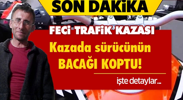 Isparta'da Feci Kaza! Bacağı Koptu