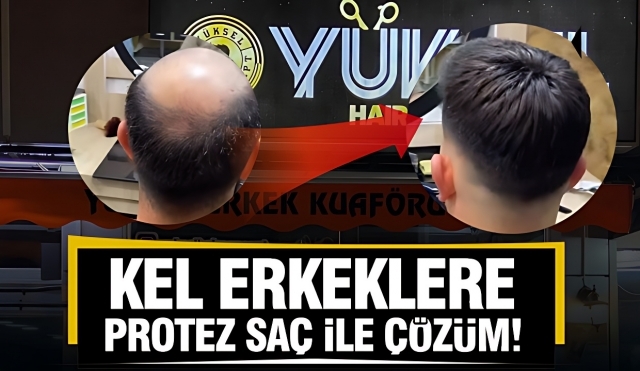 Isparta’da Doğal Görünümle Yeniden Buluşun: Yüksel Hair Concept ile Protez Saç Çözümleri