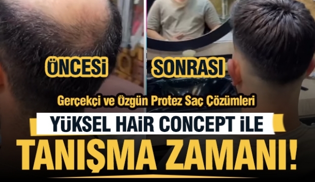 Isparta'da Doğallığın ve Estetiğin Harmanlandığı Protez Saç Çözümleri