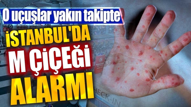 İstanbul'da Maymun Çiçeği Alarmı: Havalimanındaki Uçuşlar Yakın Takipte