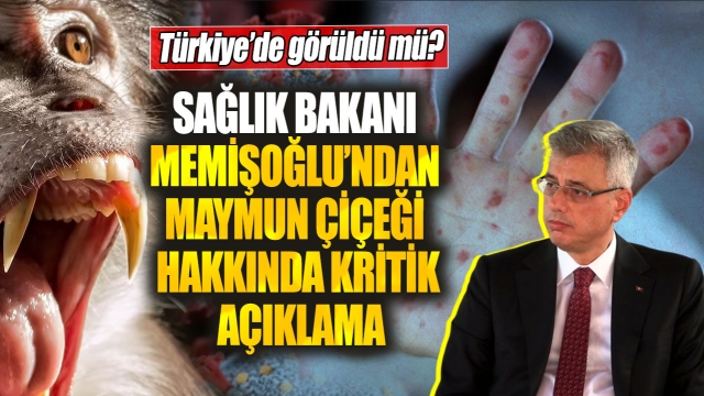 Sağlık Bakanı Memişoğlu’ndan Maymun Çiçeği Açıklaması