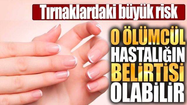 Tırnaklarınızda Fark Edilmeyen Tehlike Ne Olabilir?